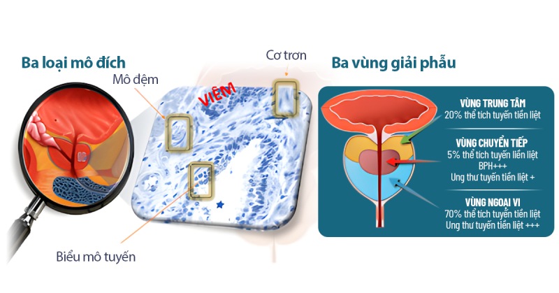 Cấu trúc của tuyến tiền liệt