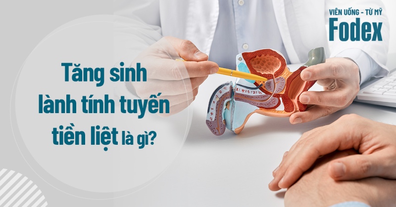 Tăng sinh lành tính tuyến tiền liệt