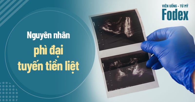 9 nguyên nhân phì đại tuyến tiền liệt và triệu chứng thường gặp