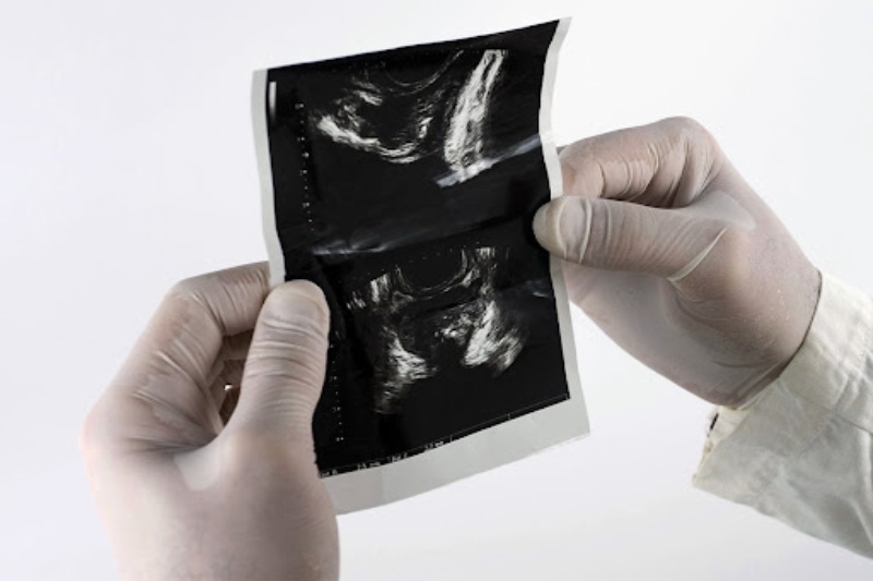 siêu âm tiền liệt tuyến