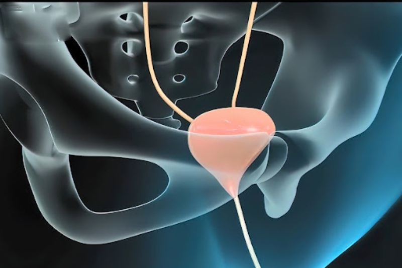 tiền liệt tuyến tại niệu đạo