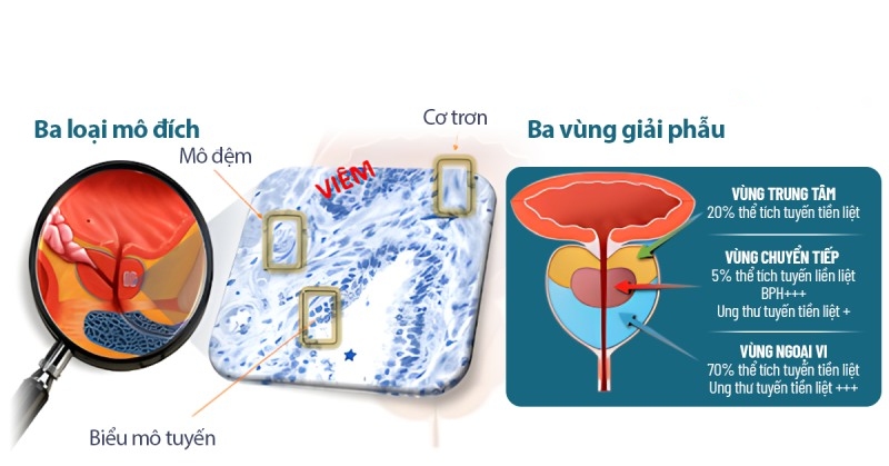cấu trúc tiền liệt tuyến