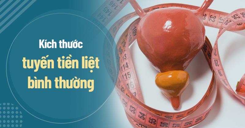 Kích thước tiền liệt tuyến bình thường như thế nào? Cách chẩn đoán