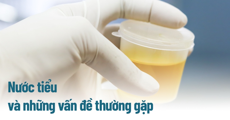 Nước tiểu (nước đái) là gì? Các vấn đề thường gặp khi tiểu tiện