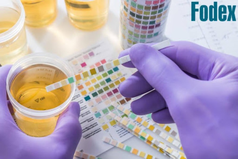 xét nghiệm nước tiểu để chẩn đoán tiểu không kiểm soát