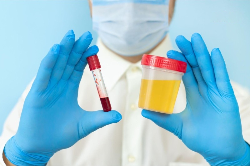 làm xét nghiệm nước tiểu