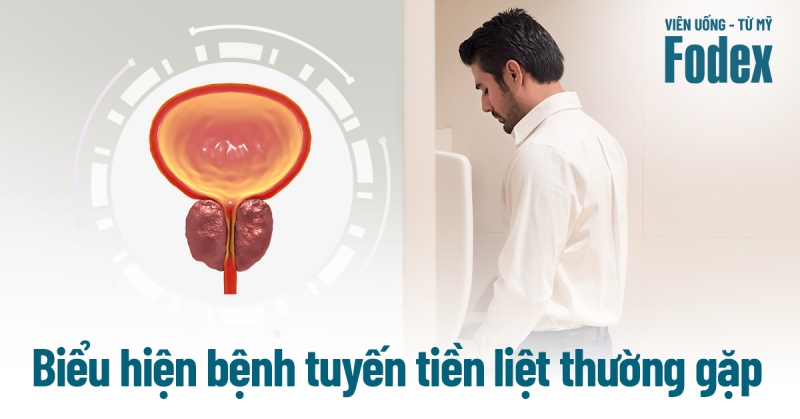 8 biểu hiện bệnh tiền liệt tuyến ở nam giới thường gặp [cần lưu ý]