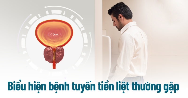 8 biểu hiện bệnh tiền liệt tuyến ở nam giới thường gặp [cần lưu ý]
