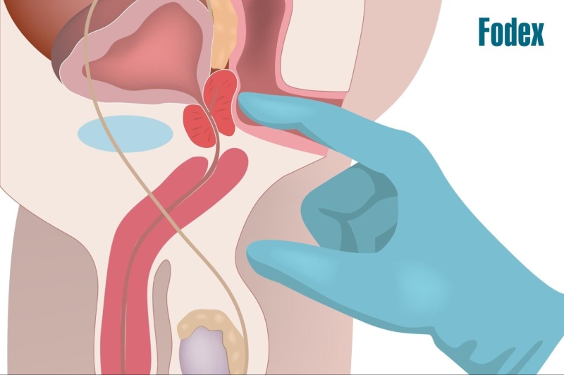 Cách kích thích tuyến tiền liệt ở nam giới