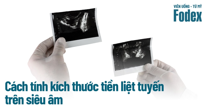 Cách tính kích thước tiền liệt tuyến trên siêu âm được bác sĩ sử dụng