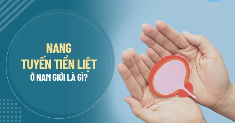 U nang tuyến tiền liệt là gì? Nguyên nhân, dấu hiệu, phòng ngừa
