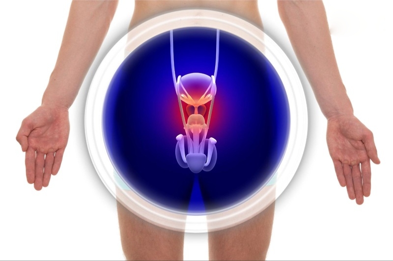 kích thước nên mổ