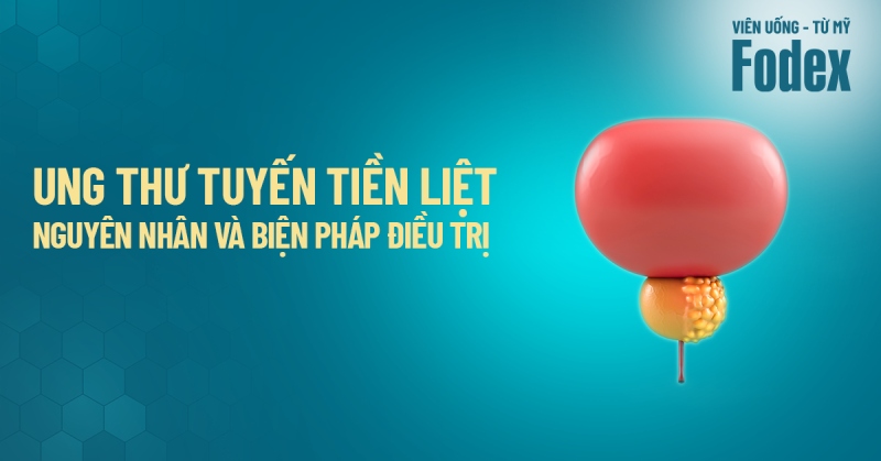Triệu chứng ung thư tuyến tiền liệt: Nguyên nhân và hình ảnh