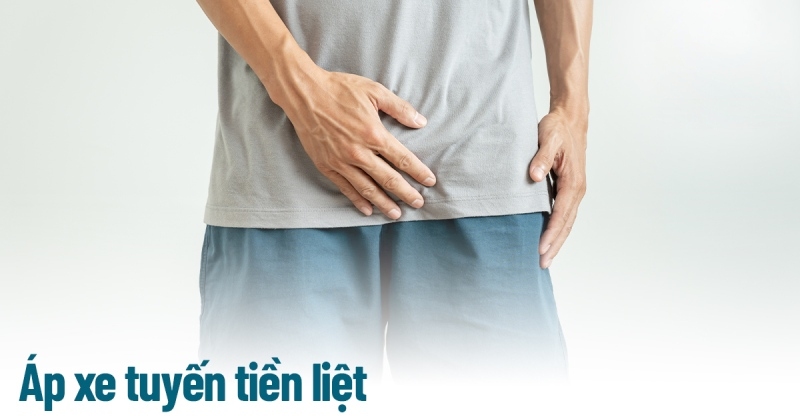 áp xe tiền liệt tuyến