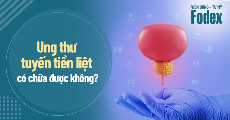 Ung thư tuyến tiền liệt có chữa được không? Có khỏi hoàn toàn?
