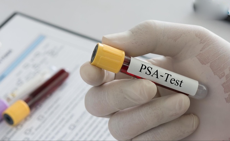 thực hiện xét nghiệm psa