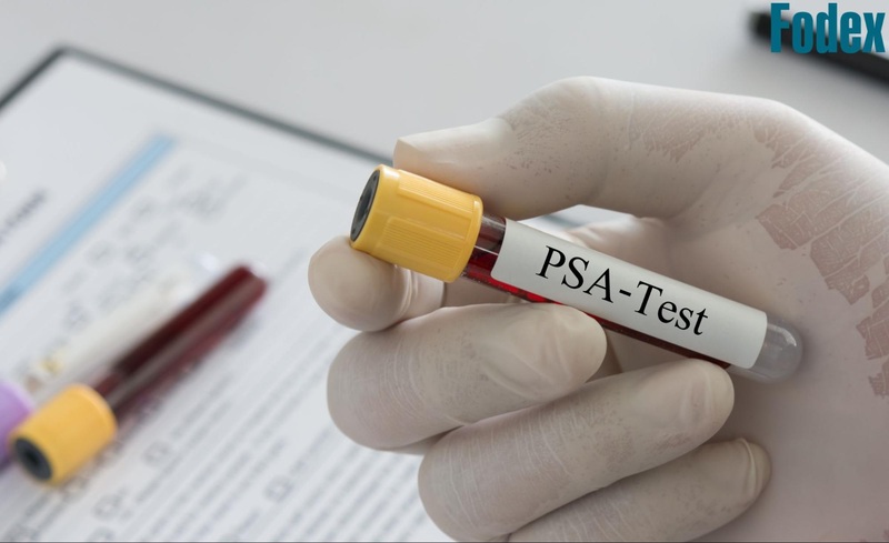 thực hiện xét nghiệm psa
