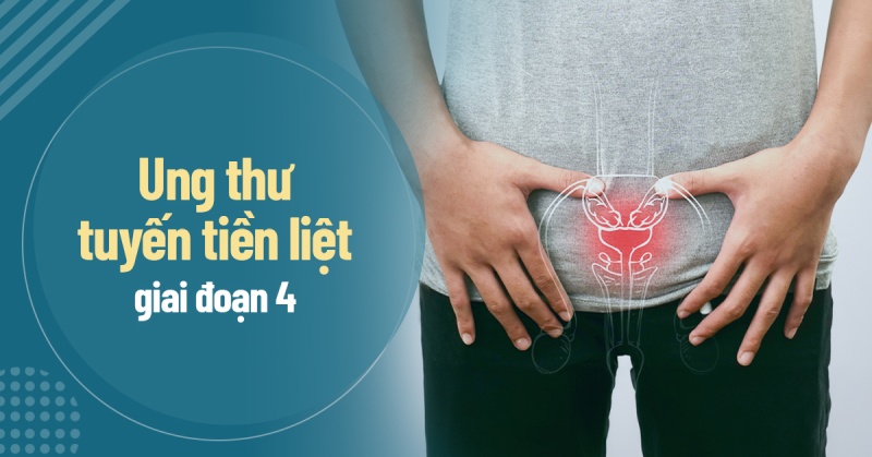Triệu chứng ung thư tuyến tiền liệt giai đoạn cuối (giai đoạn 4)