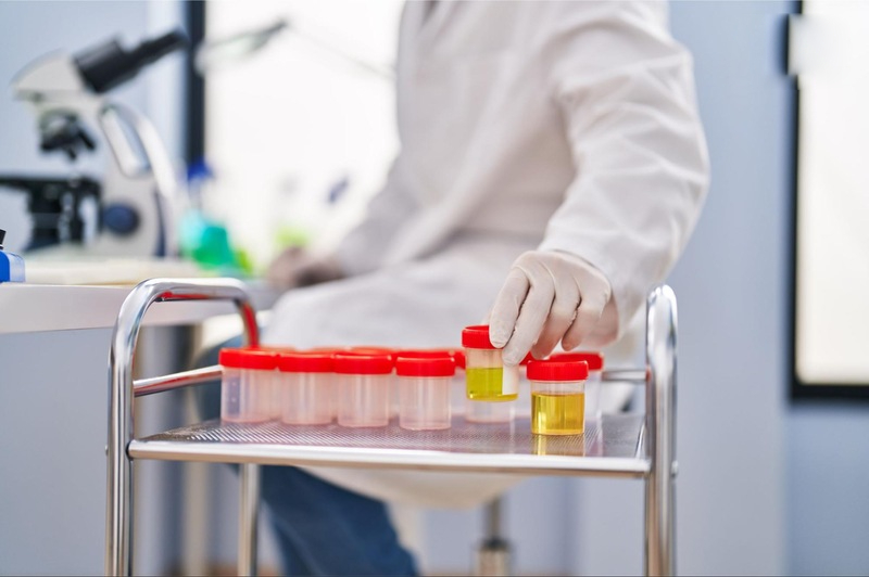 xét nghiệm nước tiểu