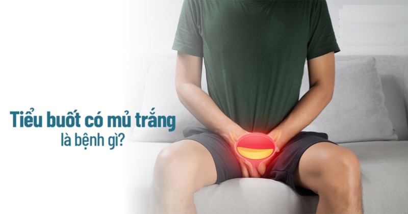 Đi tiểu buốt có mủ trắng là bệnh gì? Có ảnh hưởng gì hay không?