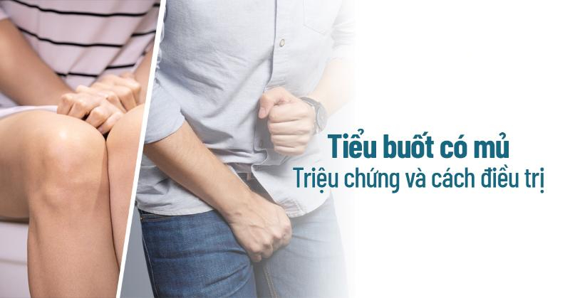 Tiểu buốt có mủ: Triệu chứng, cách điều trị, phòng ngừa thế nào?
