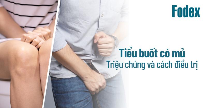 Tiểu buốt có mủ: Triệu chứng, cách điều trị, phòng ngừa thế nào?