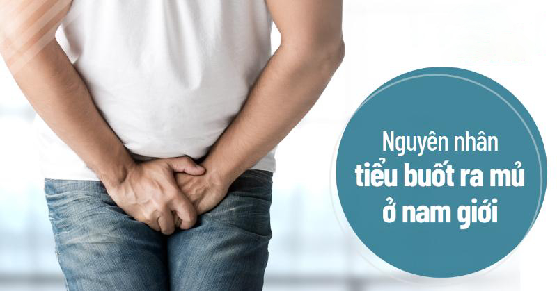 Đi tiểu buốt ra mủ ở nam giới nguyên nhân do đâu? Cần đi khám không?