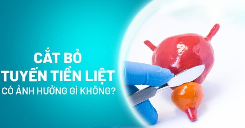 Cắt bỏ tuyến tiền liệt có ảnh hưởng gì không? Tác dụng phụ cần lưu ý