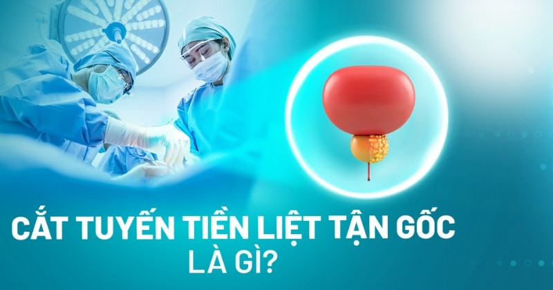 Cắt tiền liệt tuyến tận gốc ảnh hưởng thế nào đến người bệnh?