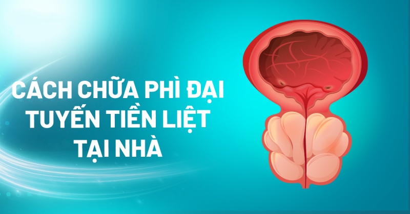7 cách chữa phì đại tuyến tiền liệt tại nhà an toàn và hiệu quả cao