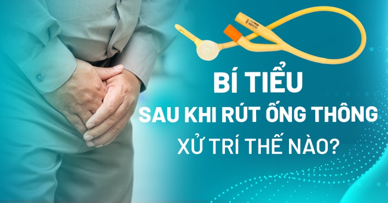 Bí tiểu sau khi rút ống thông xử trí thế nào? Nguyên nhân do đâu?