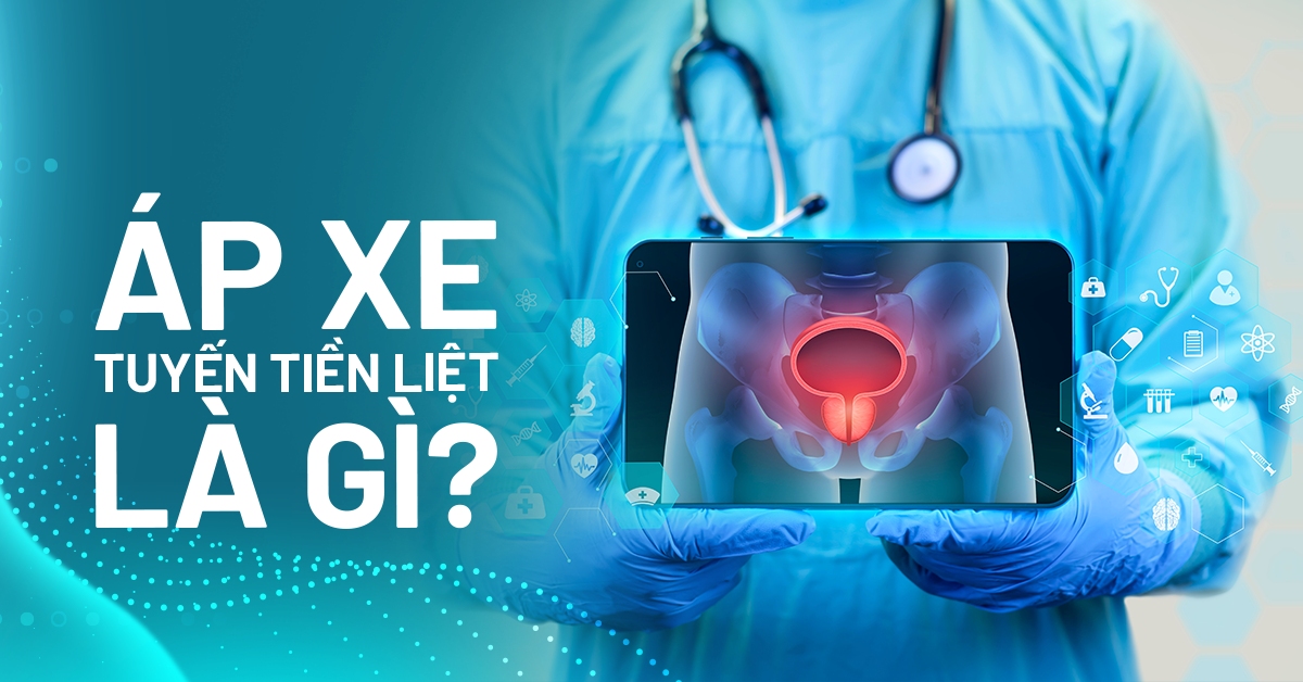 Áp xe tuyến tiền liệt và những cảnh báo quan trọng