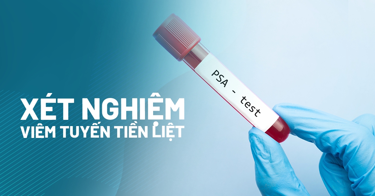 Các phương pháp xét nghiệm viêm tuyến tiền liệt hiện đại, chính xác