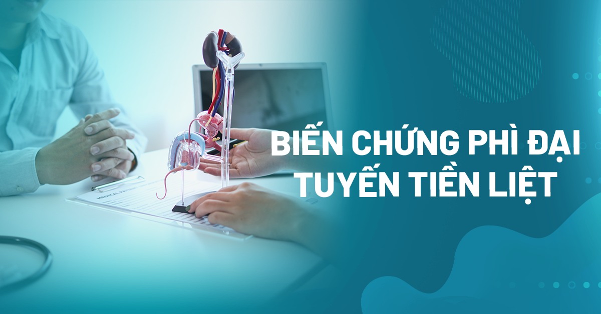 6 biến chứng phì đại tuyến tiền liệt cần lưu ý ngay