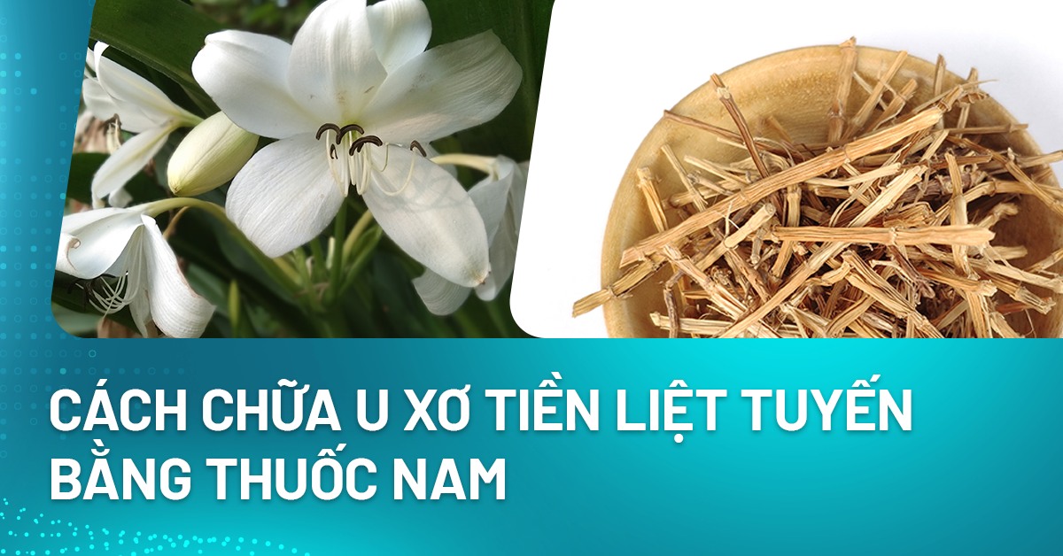 Cách chữa u xơ tiền liệt tuyến bằng thuốc nam an toàn