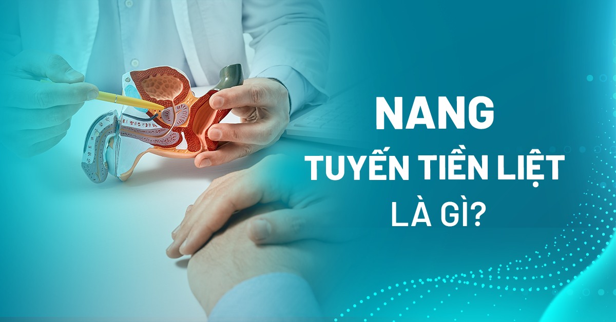 Nang tuyến tiền liệt là gì? Có phải lành tính không?