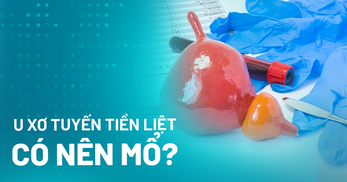 U xơ tuyến tiền liệt có nên mổ không? Bác sĩ chỉ định khi nào?