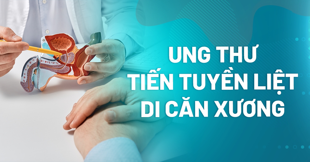 Phát hiện ung thư tiền liệt tuyến di căn xương cần làm gì?