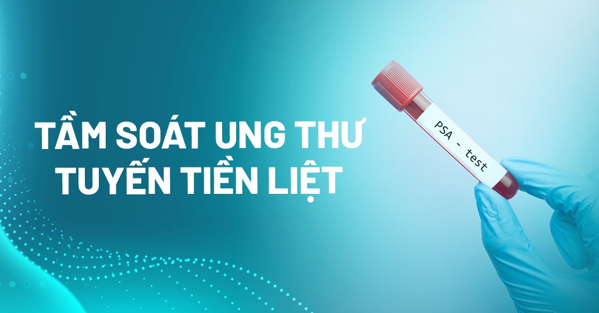 khám tầm soát ung thư tuyến tiền liệt