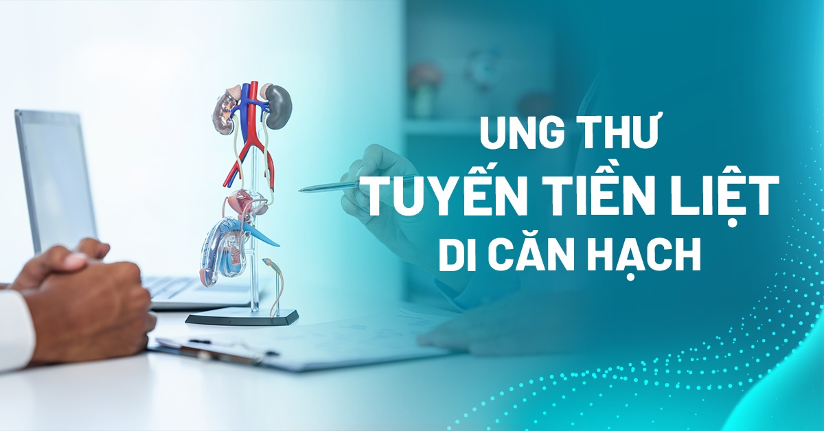 Tình trạng ung thư tuyến tiền liệt di căn hạch là như thế nào?